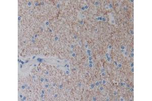 Used in DAB staining on fromalin fixed paraffin- embedded Kidney tissue (Neurotrypsin anticorps  (AA 17-235))