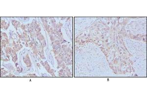 Immunohistochemical analysis of paraffin-embedded human breast cancer,Lung breast tissues using EGF mouse mAb (EGF anticorps)