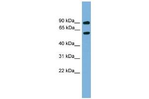 WB Suggested Anti-Nab2 Antibody Titration:  0. (NAB2 anticorps  (Middle Region))