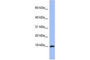 Image no. 1 for anti-Acyl-CoA Binding Domain Containing 7 (ACBD7) (N-Term) antibody (ABIN6744031) (ACBD7 anticorps  (N-Term))