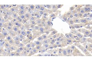 Detection of CP in Rat Liver Tissue using Polyclonal Antibody to Ceruloplasmin (CP)