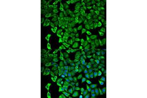 Immunofluorescence analysis of HeLa cell using PSMD2 antibody. (PSMD2 anticorps  (AA 1-260))