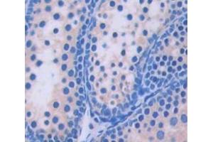 IHC-P analysis of Kidney tissue, with DAB staining. (PEX1 anticorps  (AA 172-377))