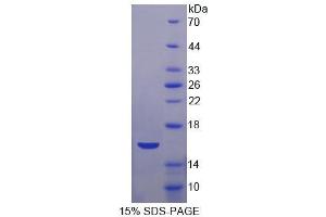 SDS-PAGE of Protein Standard from the Kit (Highly purified E.