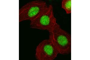 Fluorescent image of A549 cell stained with HMGA1 Antibody . (HMGA1 anticorps  (C-Term))