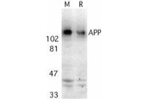 Western blot analysis of APP in mouse (M) and rat (R) brain tissue lysates with AP30071PU-N APP antibody at 2 μg/ml. (APP anticorps  (C-Term))