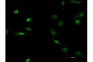 Immunofluorescence of monoclonal antibody to LMNB1 on HeLa cell.