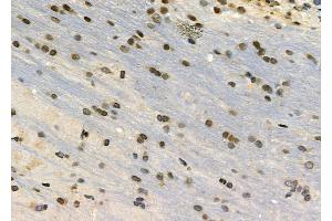 ABIN6263046 and ABIN6272340 at 1/100 staining Rat brain tissue by IHC-P. (CHRM4 anticorps  (Internal Region))