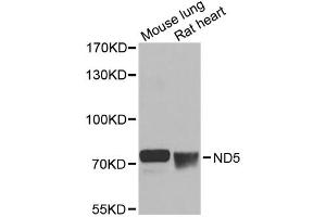 Western blot analysis of extracts of various cell lines, using ND5 antibody (ABIN6294088) at 1:1000 dilution. (MT-ND5 anticorps)