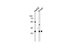 Western blot analysis of lysates from HepG2 cell line, mouse liver tissue lysate (from left to right), using CTDSP1 Antibody (N-term) (ABIN6243354 and ABIN6577527). (CTDSP1 anticorps  (N-Term))