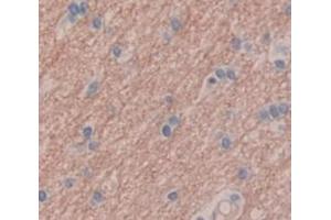 IHC-P analysis of Human Tissue, with DAB staining. (GRIP1 anticorps  (AA 79-268))