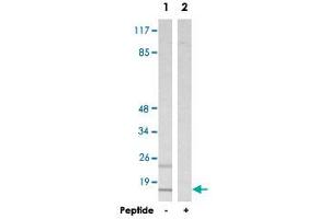 Western blot analysis of extracts from HepG2 cells, using MRPS16 polyclonal antibody . (MRPS16 anticorps)