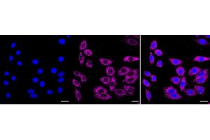 Immunocytochemical staining of HepG2 cells with PUM1 antibody (ABIN7800064), 1:1,000).