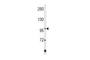 Western blot analysis of COL6A1 antibody (C-term) (ABIN390513 and ABIN2840867) in Y79 cell line lysates (35 μg/lane).