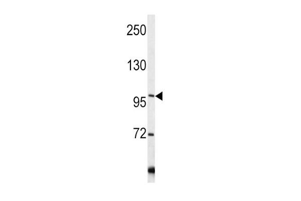 COL6A1 anticorps  (C-Term)