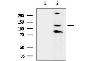 anti-WD Repeat Domain 60 (WDR60) antibody