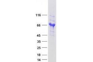 Validation with Western Blot