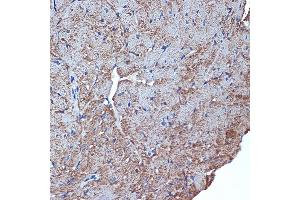 Immunohistochemistry of paraffin-embedded mouse heart using CDC42EP1 Rabbit mAb (ABIN7266231) at dilution of 1:100 (40x lens). (CDC42EP1 anticorps)