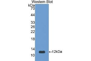 Western Blotting (WB) image for anti-serpin Peptidase Inhibitor, Clade A (Alpha-1 Antiproteinase, Antitrypsin), Member 12 (SERPINA12) (AA 52-143) antibody (ABIN3208033) (SERPINA12 anticorps  (AA 52-143))