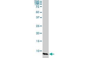 ATOX1 monoclonal antibody (M03A), clone 3D10. (ATOX1 anticorps  (AA 1-68))