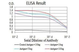 Black line: Control Antigen (100 ng),Purple line: Antigen (10 ng), Blue line: Antigen (50 ng), Red line:Antigen (100 ng)