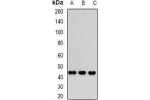 Western blot analysis of Dnmt3L expression in PC3 (A), Jurkat (B), MCF7 (C) whole cell lysates. (DNMT3L anticorps)