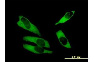 Immunofluorescence of purified MaxPab antibody to ABCF1 on HeLa cell.