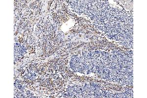 IHC analysis of GFPT1 using anti-GFPT1 antibody (ABIN7602887). (GFPT1 anticorps  (C-Term))