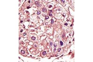 Image no. 2 for anti-Transforming Growth Factor, beta Receptor 1 (TGFBR1) (Middle Region) antibody (ABIN360163)