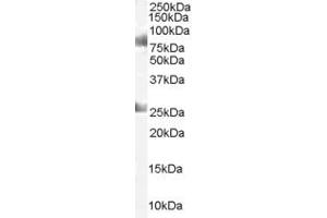 Western Blotting (WB) image for anti-Chromodomain Protein, Y-Like (CDYL) (C-Term) antibody (ABIN2465195) (CDYL anticorps  (C-Term))