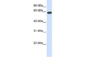 SLC39A4 antibody used at 1 ug/ml to detect target protein. (SLC39A4 anticorps)