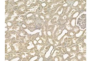 ABIN6258467 and ABIN6275239 at 1/100 staining human normal kidney tissue by IHC-P. (MRPS36 anticorps  (Internal Region))