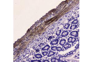 anti-Myosin Light Chain Kinase (MYLK) (AA 1441-1709) antibody