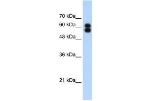 ALPP antibody used at 1. (PLAP anticorps)