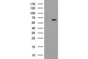 Western Blotting (WB) image for anti-Glucokinase (Hexokinase 4) Regulator (GCKR) antibody (ABIN1498414) (GCKR anticorps)