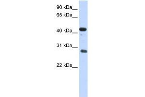 WB Suggested Anti-CDCA5 Antibody Titration: 0. (CDCA5 anticorps  (Middle Region))