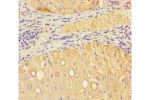 Immunohistochemistry of paraffin-embedded human liver tissue using ABIN7175549 at dilution of 1:100