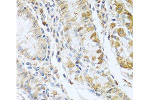 Immunohistochemistry of paraffin-embedded Human stomach using RNASE13 Polyclonal Antibody at dilution of 1:100 (40x lens). (RNASE13 anticorps)