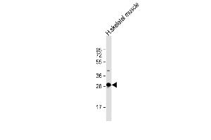 Anti-DNASE1L2 Antibody (C-Term) at 1:2000 dilution + human skeletal muscle lysate Lysates/proteins at 20 μg per lane. (DNASE1L2 anticorps  (AA 199-229))