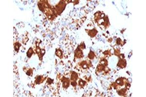 IHC testing of FFPE human pituitary gland with ACTH antibody (clone ADCT1-1). (CLIP anticorps  (AA 25-39))