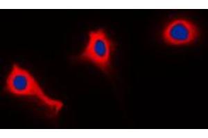 Immunofluorescent analysis of p47 phox (pS370) staining in THP1 cells. (NCF1 anticorps  (C-Term, pSer370))