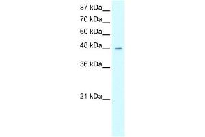 WB Suggested Anti-HMG20A Antibody Titration:  0. (HMG20A anticorps  (Middle Region))