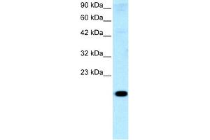 WB Suggested Anti-CITED1 Antibody Titration:  0.