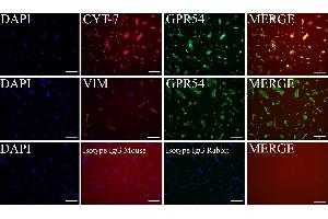 Characterization of primary cultures of first trimester trophoblast cells.