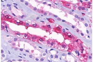 Anti-GPR91 antibody  ABIN1048899 IHC staining of human kidney, medulla. (SUCNR1 anticorps  (Cytoplasmic Domain))