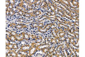 ABIN7096909 and ABIN7100975 at 1/100 staining mouse kidney tissue by IHC-P.