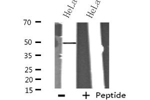 Western blot analysis of extracts from HeLa cells using ITPK1 antibody. (ITPK1 anticorps  (Internal Region))