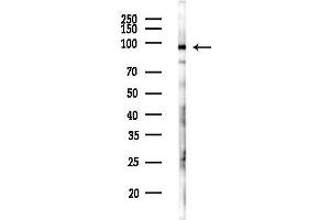 anti-WD Repeat Domain 70 (WDR70) antibody