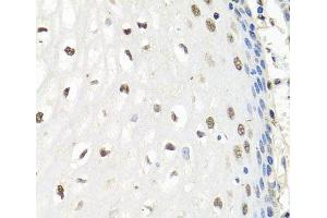 Immunohistochemistry of paraffin-embedded Human esophagus using CNOT8 Polyclonal Antibody at dilution of 1:100 (40x lens).