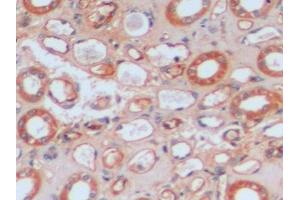 Detection of ICAM1 in Human Kidney Tissue using Polyclonal Antibody to Intercellular Adhesion Molecule 1 (ICAM1)